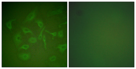 Mammaglobin A Rabbit Polyclonal Antibody