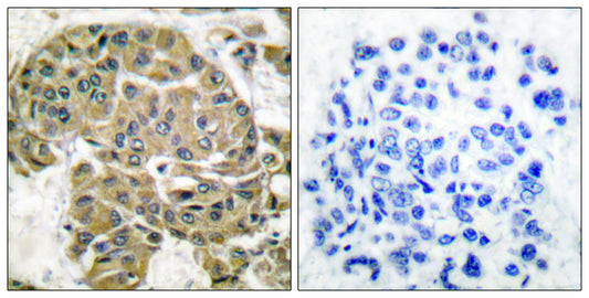 Mammaglobin B Rabbit Polyclonal Antibody