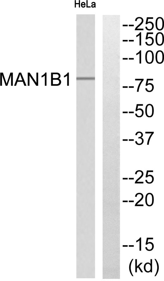 MAN1B1 Rabbit Polyclonal Antibody