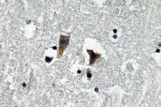 MAO-A Rabbit Polyclonal Antibody