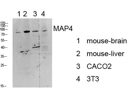 MAP4 Rabbit Polyclonal Antibody