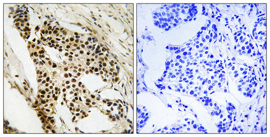 MAPKAPK-2 Rabbit Polyclonal Antibody
