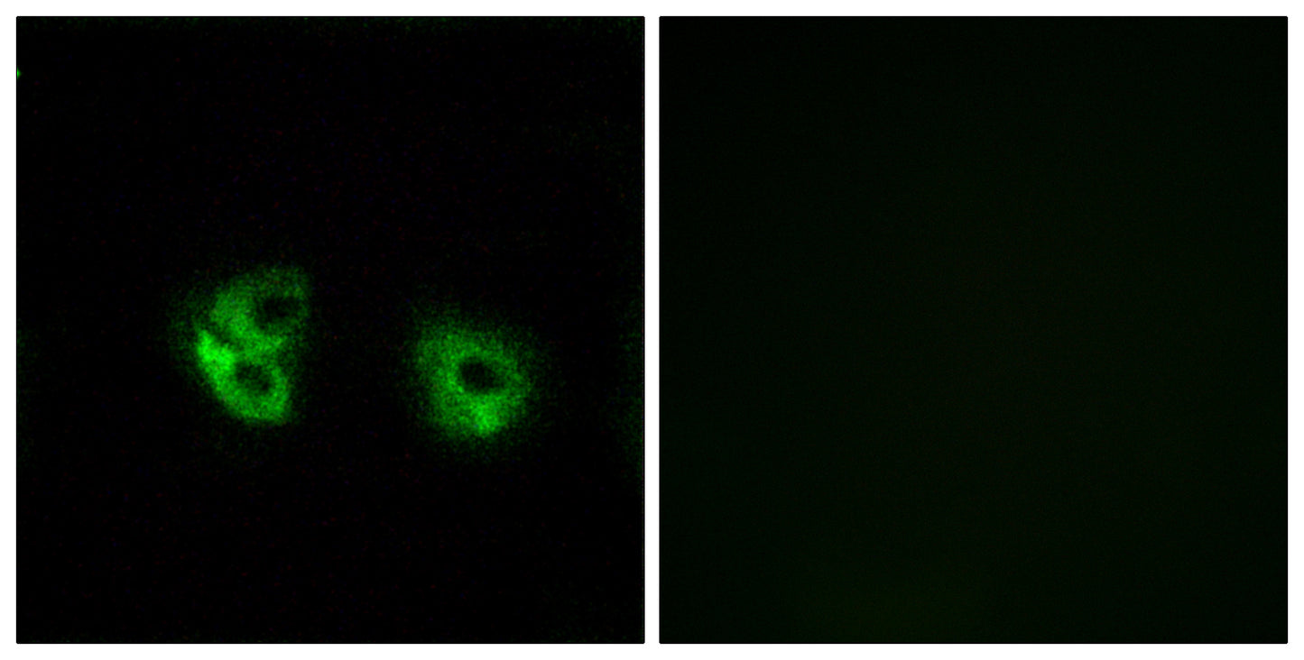 MARCH2 Rabbit Polyclonal Antibody
