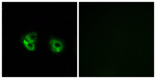 MARCH2 Rabbit Polyclonal Antibody