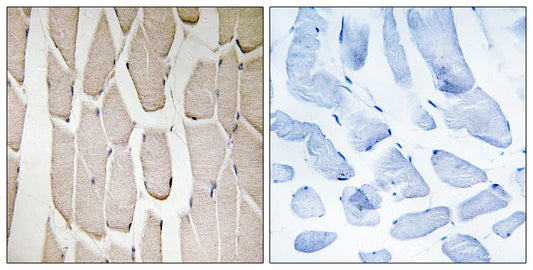 MARCH3 Rabbit Polyclonal Antibody