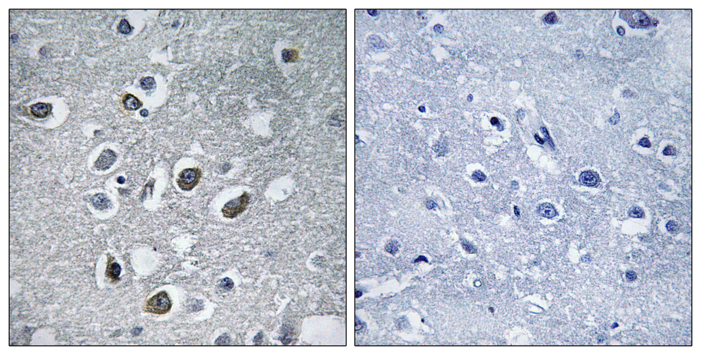 MARCH4 Rabbit Polyclonal Antibody