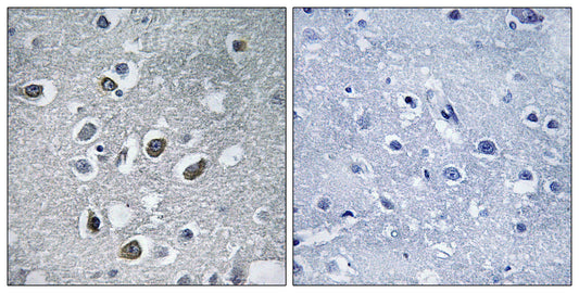 MARCH4 Rabbit Polyclonal Antibody