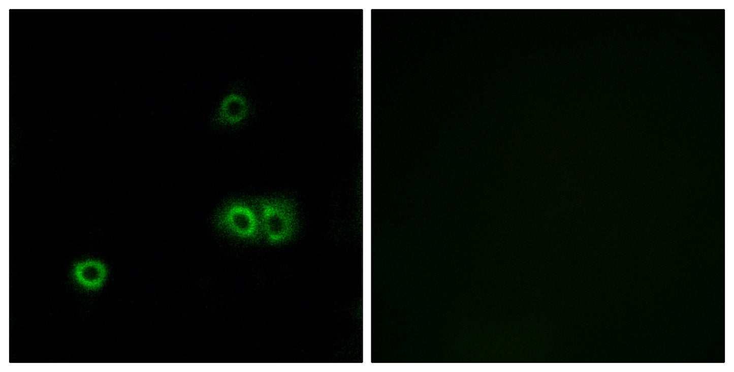 MARCH5 Rabbit Polyclonal Antibody