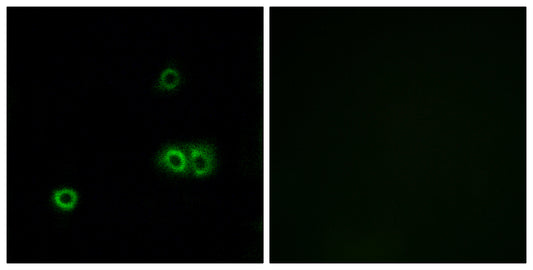 MARCH5 Rabbit Polyclonal Antibody