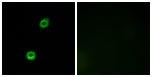 MARCKS Rabbit Polyclonal Antibody