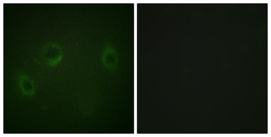 MARK1/2/3/4 Rabbit Polyclonal Antibody