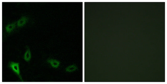 MARK2 Rabbit Polyclonal Antibody