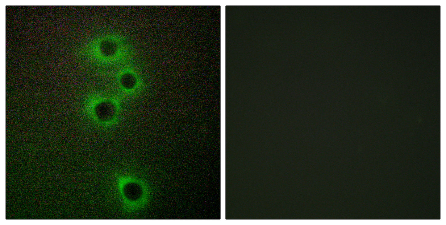 MARK4 Rabbit Polyclonal Antibody
