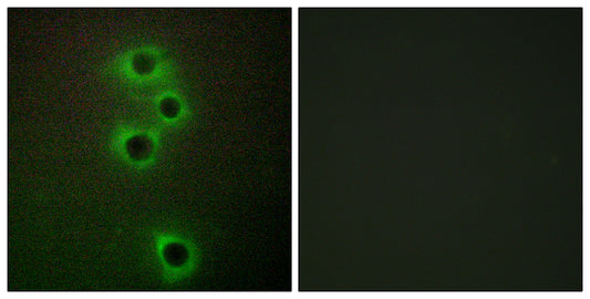 MARK4 Rabbit Polyclonal Antibody