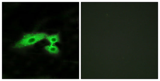 Mas1-like Rabbit Polyclonal Antibody