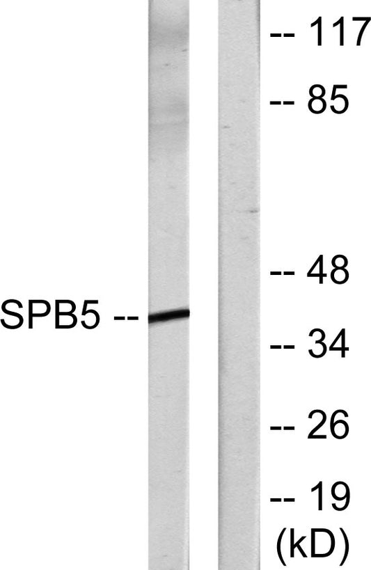 Maspin Rabbit Polyclonal Antibody