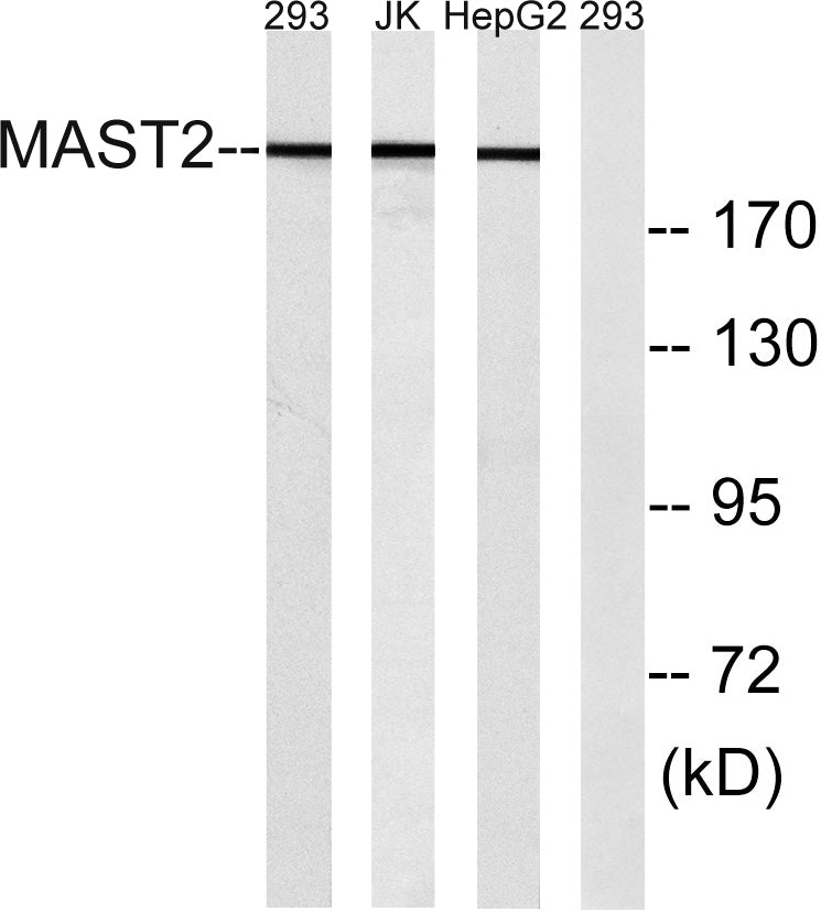 MAST205 Rabbit Polyclonal Antibody