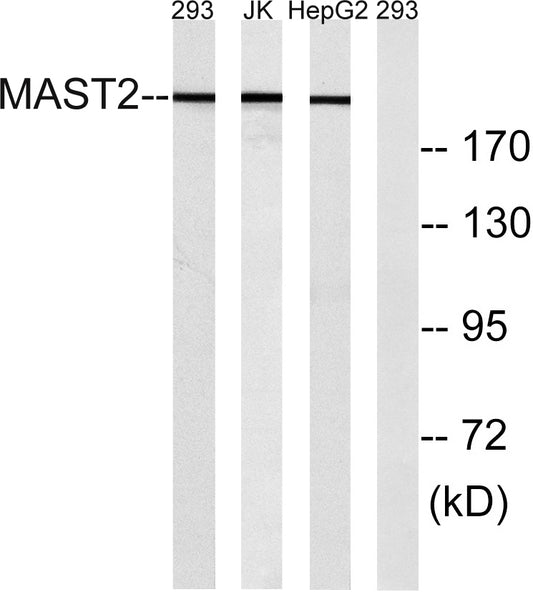 MAST205 Rabbit Polyclonal Antibody