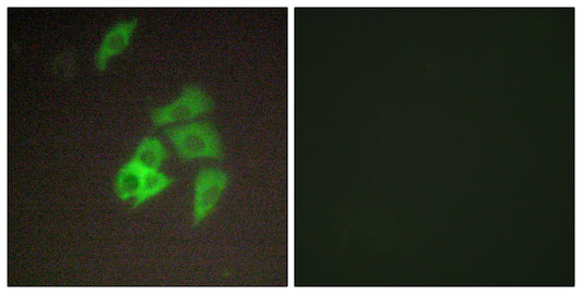 Matriptase Rabbit Polyclonal Antibody