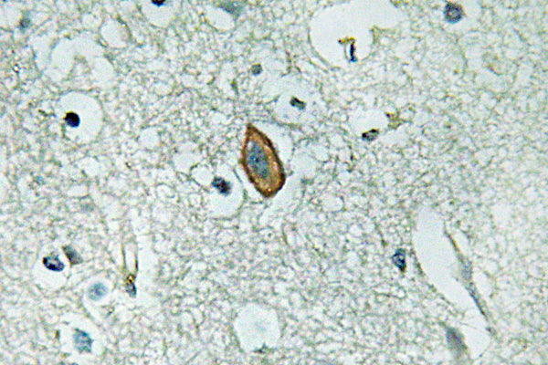 MaxiKα Rabbit Polyclonal Antibody