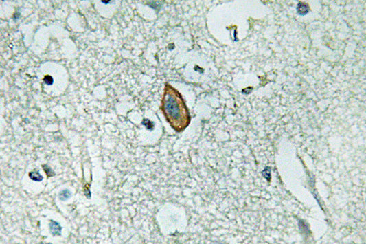 MaxiKα Rabbit Polyclonal Antibody
