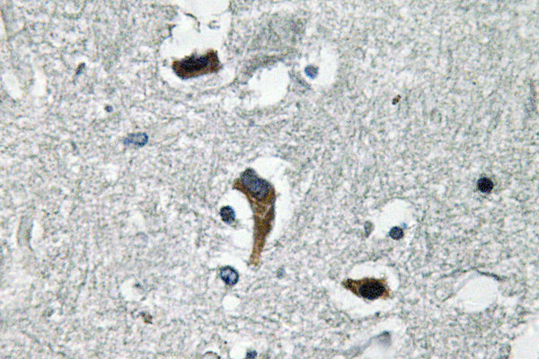 MaxiKβ Rabbit Polyclonal Antibody