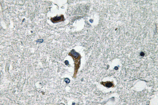 MaxiKβ Rabbit Polyclonal Antibody