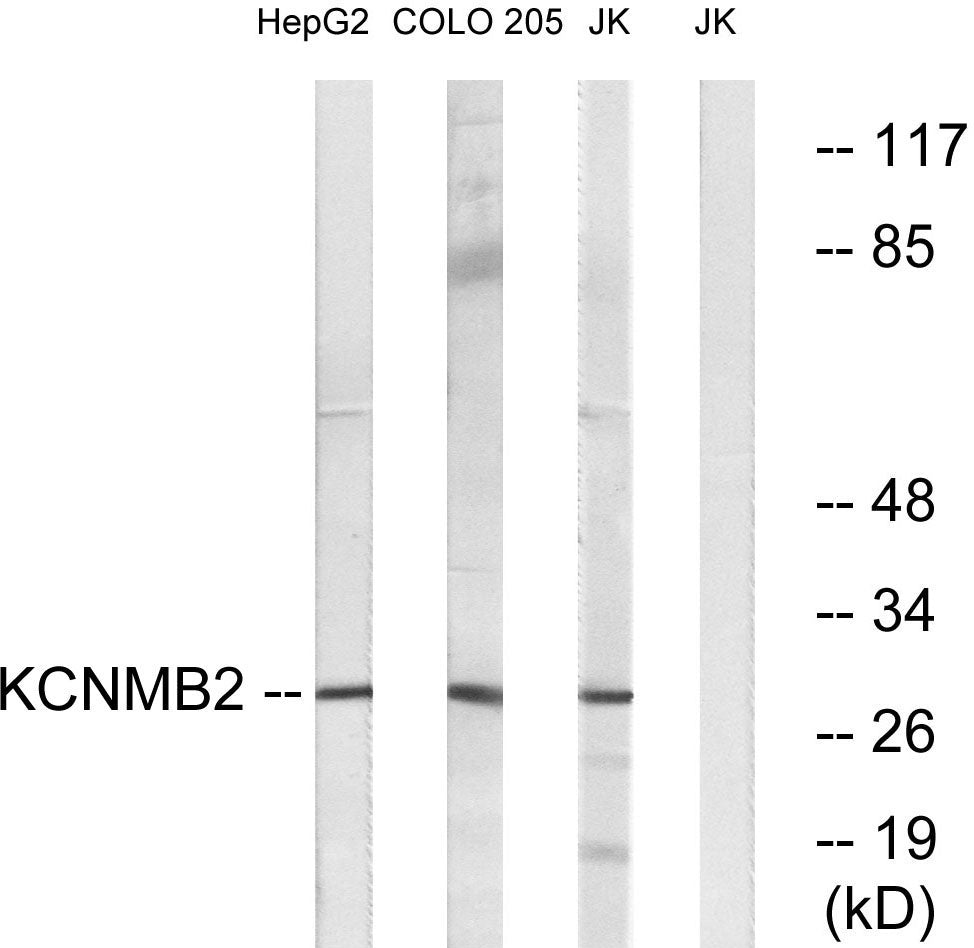 MaxiKβ2 Rabbit Polyclonal Antibody