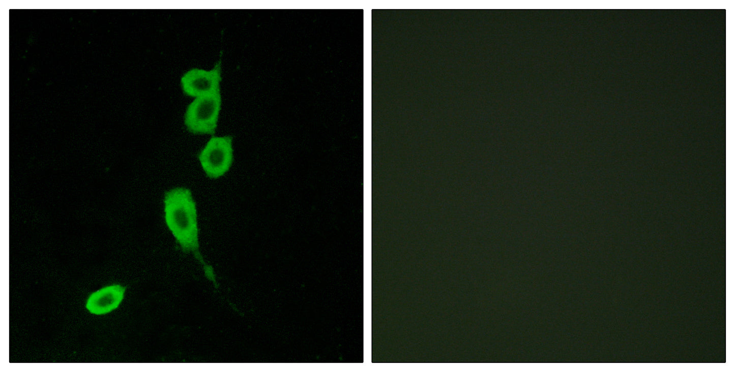 MC1-R Rabbit Polyclonal Antibody