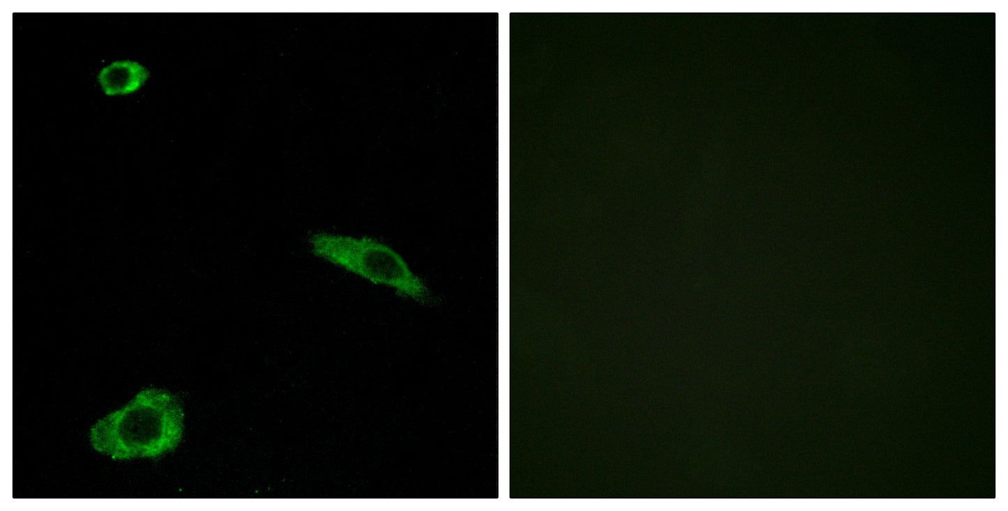 MC2-R Rabbit Polyclonal Antibody