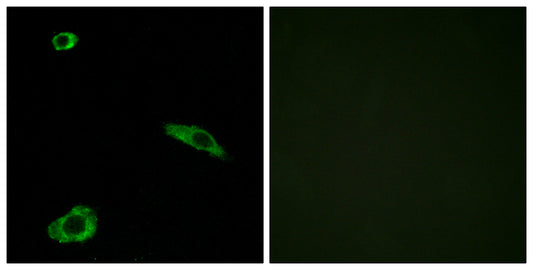 MC2-R Rabbit Polyclonal Antibody