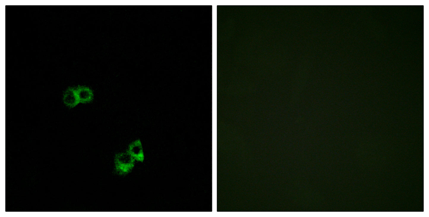 MC5-R Rabbit Polyclonal Antibody