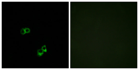 MC5-R Rabbit Polyclonal Antibody