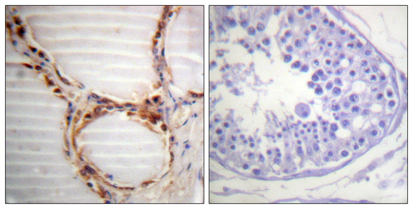 MCM4 Rabbit Polyclonal Antibody