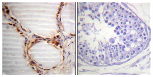 MCM4 Rabbit Polyclonal Antibody
