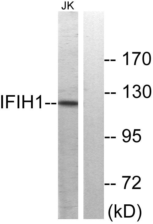 MDA5 Rabbit Polyclonal Antibody