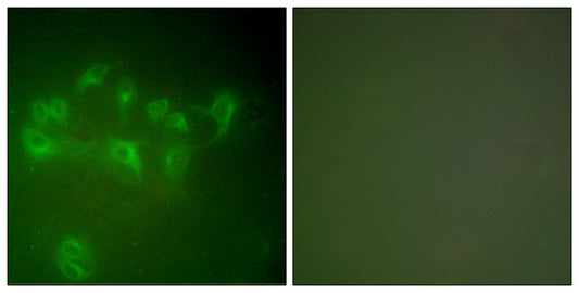 Mdm2 Rabbit Polyclonal Antibody