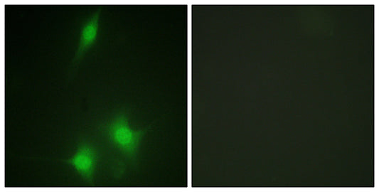 MDM2 Rabbit Polyclonal Antibody