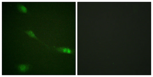 MDM2 Rabbit Polyclonal Antibody