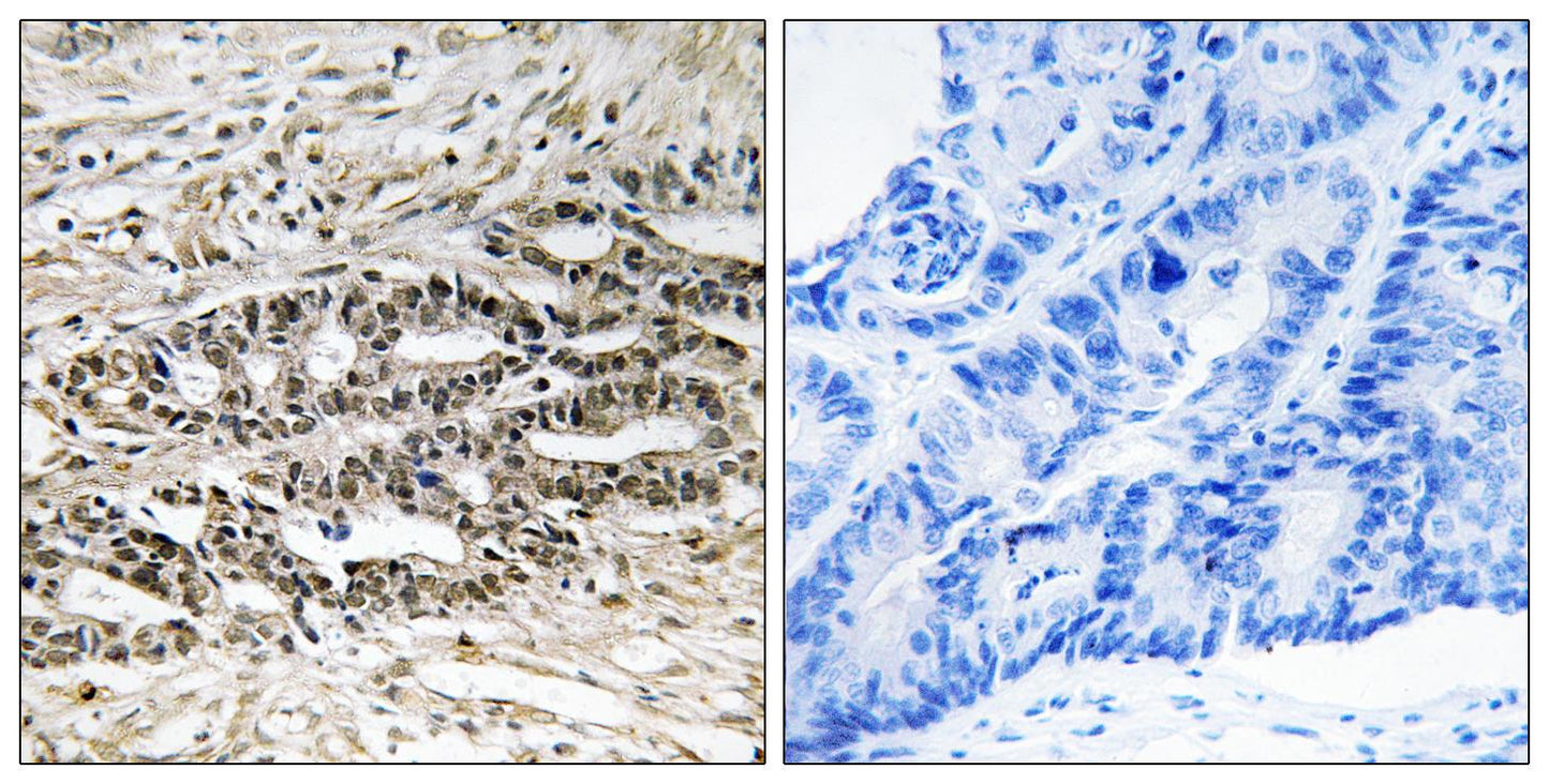 MDMX Rabbit Polyclonal Antibody
