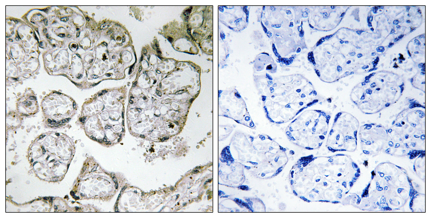 ME2 Rabbit Polyclonal Antibody