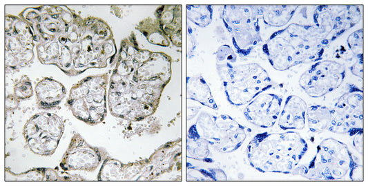 ME2 Rabbit Polyclonal Antibody