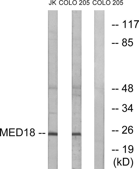 Med18 Rabbit Polyclonal Antibody