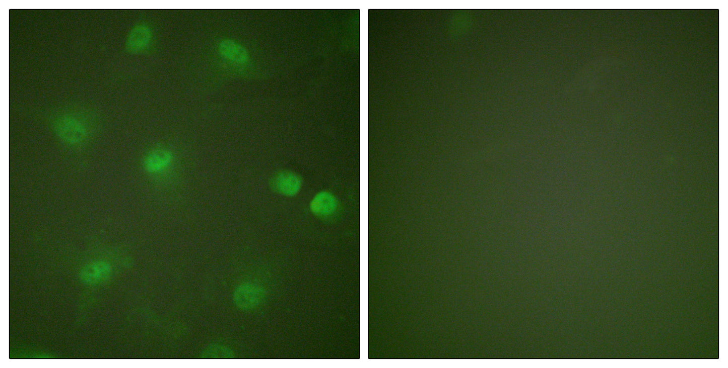MEF-2 Rabbit Polyclonal Antibody