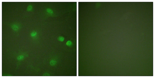 MEF-2 Rabbit Polyclonal Antibody