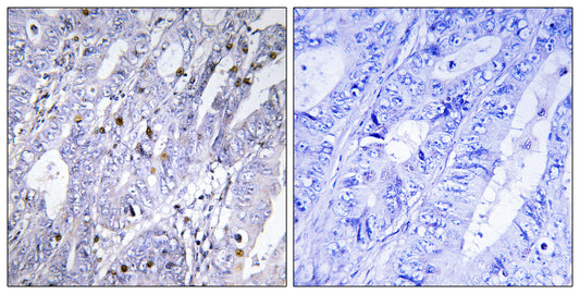 MEF-2D Rabbit Polyclonal Antibody