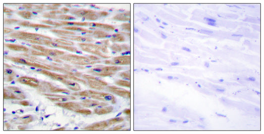 MEK Kinase-4 Rabbit Polyclonal Antibody