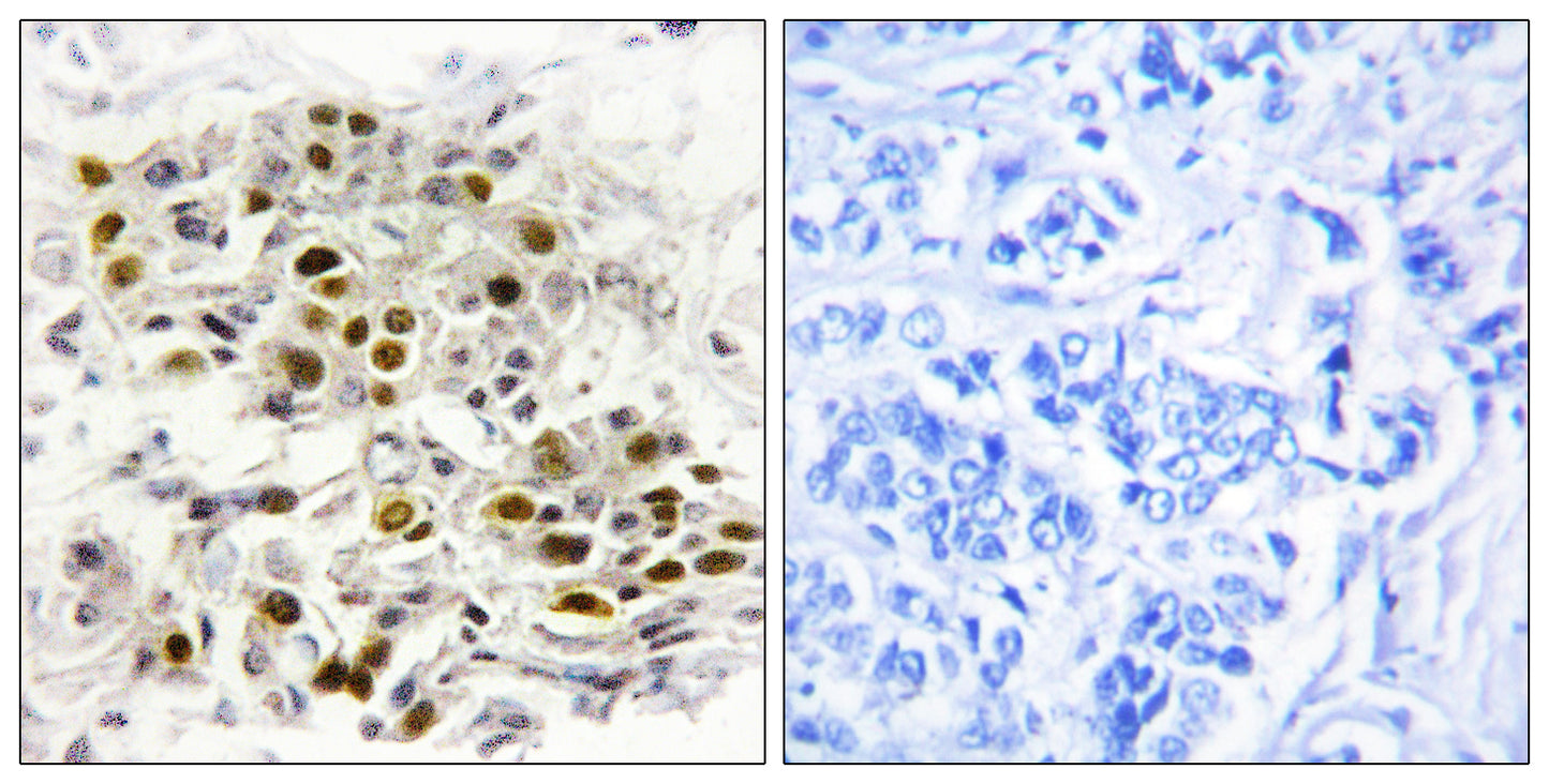 MEK Kinase-6 Rabbit Polyclonal Antibody