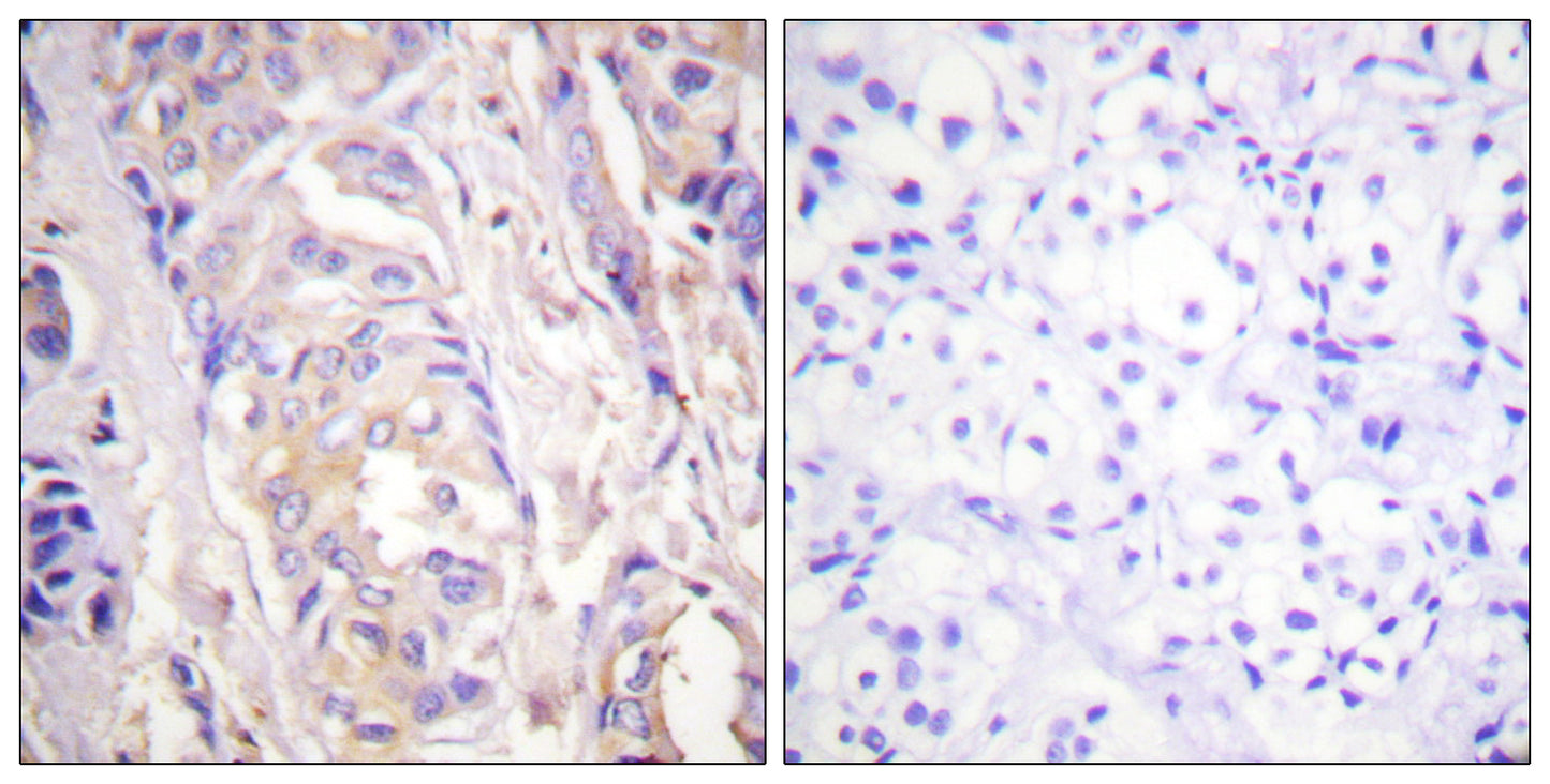MEK-1 Rabbit Polyclonal Antibody