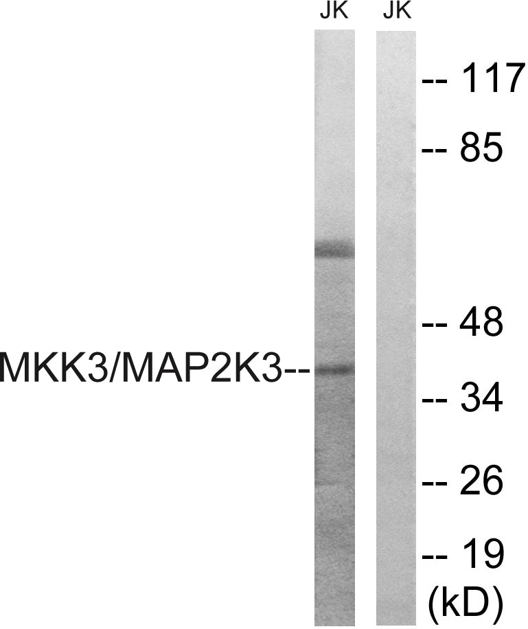MEK-3 Rabbit Polyclonal Antibody
